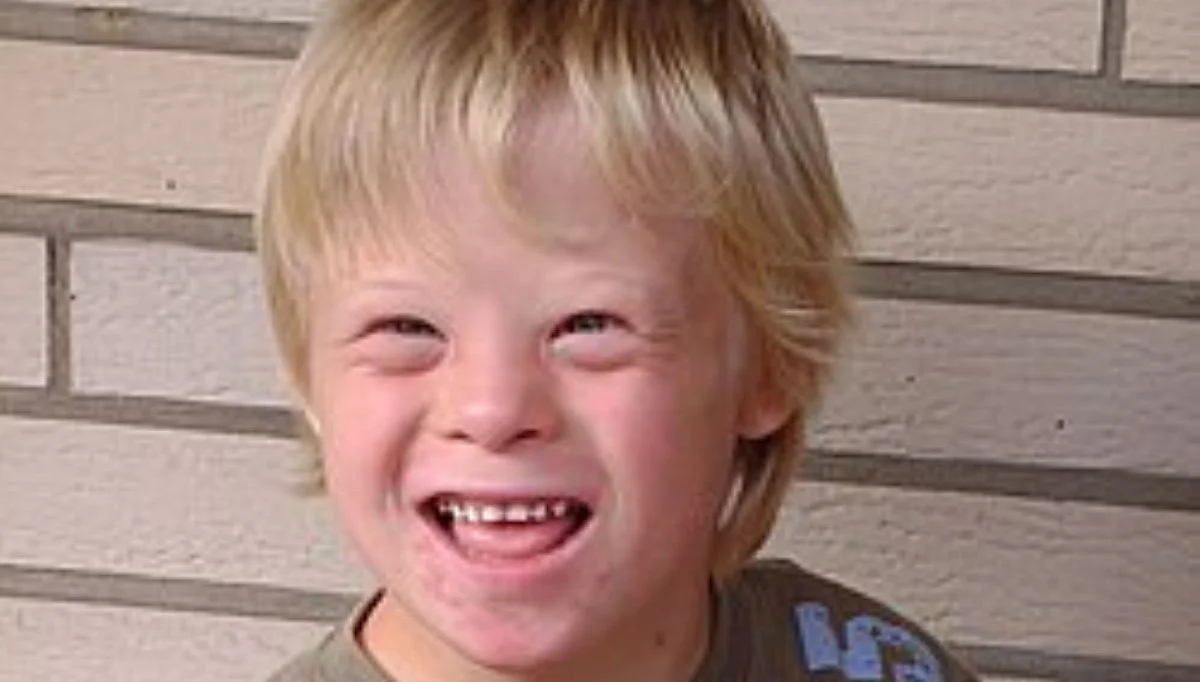 Boy_with_Down_Syndrome